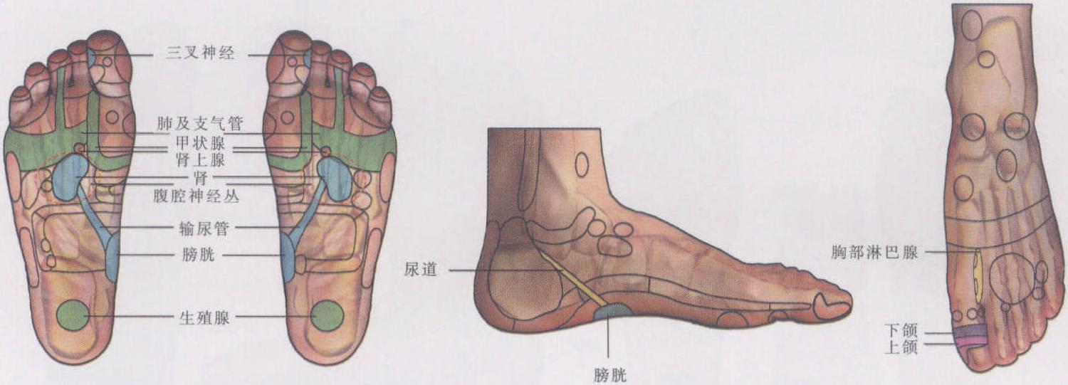 雀斑